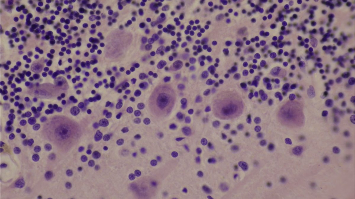 Micrograph of stained neurons in nervous tissue — the microscopy that places neuropeptides such as APGWamide onto identified cells; an APGWamide feature by Panacea Bio Chem and Bogdan Dicoias